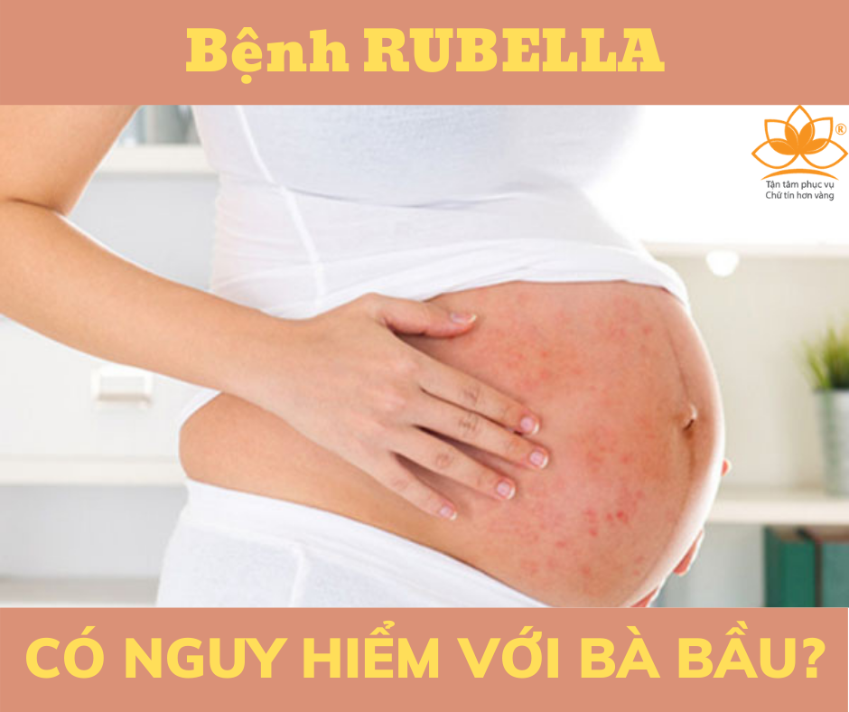 Nguyên nhân và đường lây bệnh Rubella